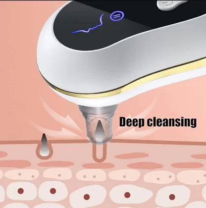 Limpador Facial Removedor Resíduos de Maquiagem e Cravos -  Aspirador por Sucção a Vácuo - USB - Image 8