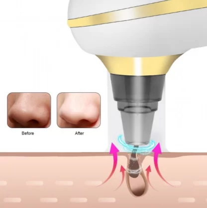 Limpador Facial Removedor Resíduos de Maquiagem e Cravos -  Aspirador por Sucção a Vácuo - USB - Image 3
